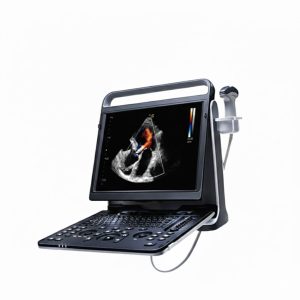 harga usg sogata sg90 premium